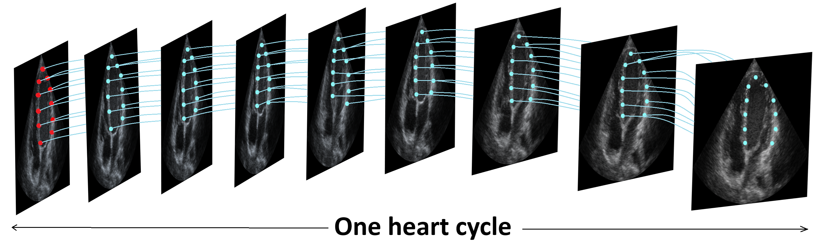 Point tracking in echocardiography.